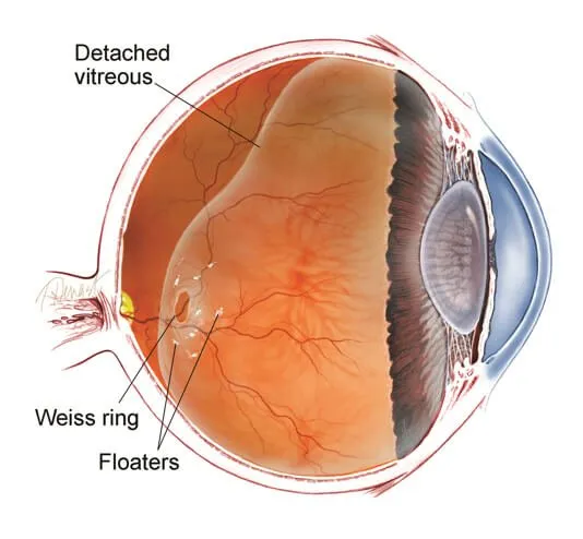 detached-vitrious-diagram-2880w