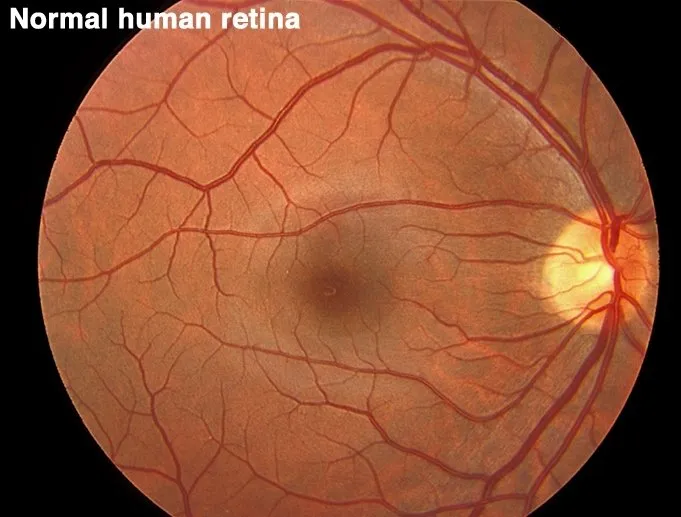 normalfundus-2880w